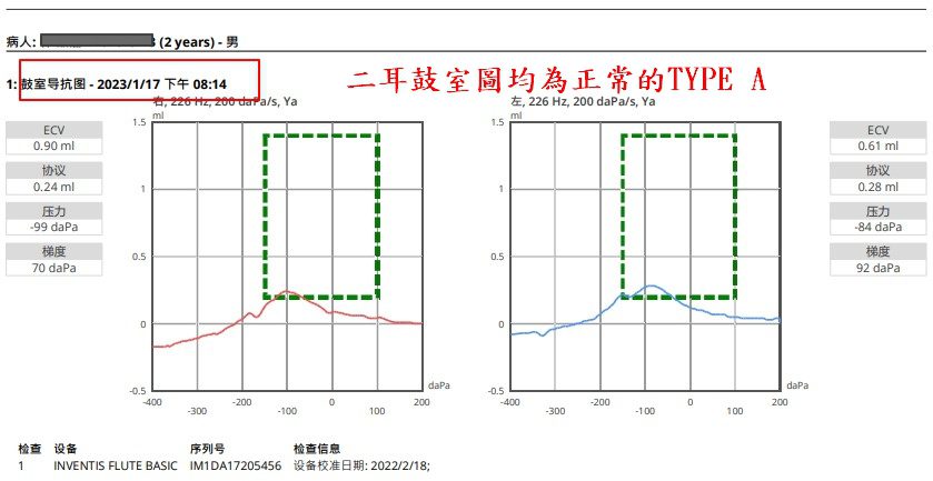 耳壓均為TYPE A