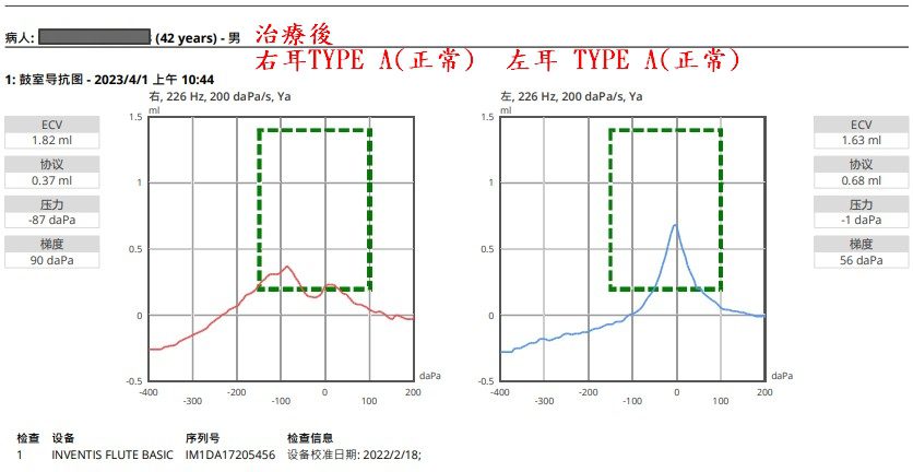 治療後耳壓