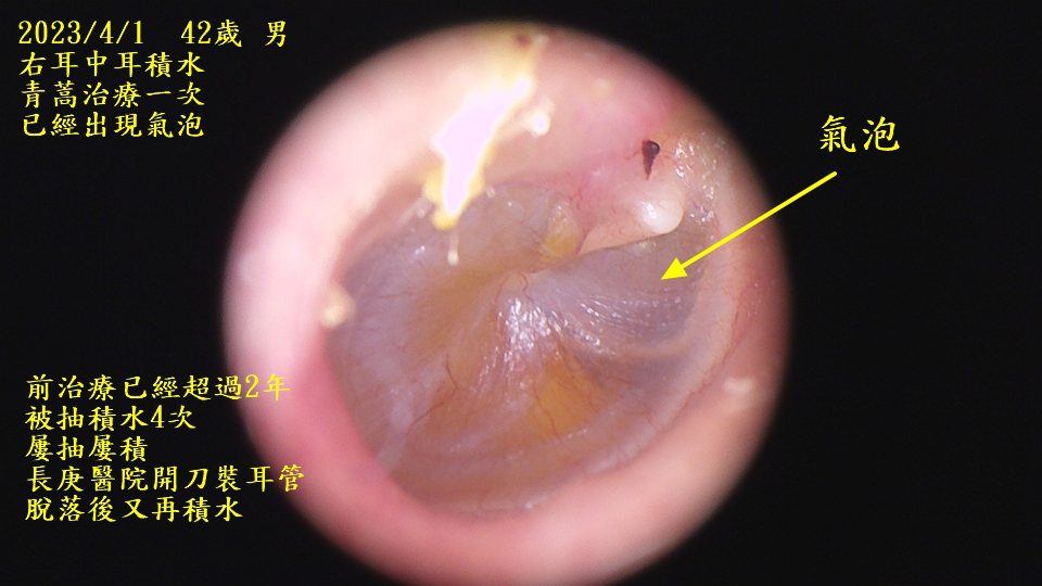 耳鼻喉科庸醫